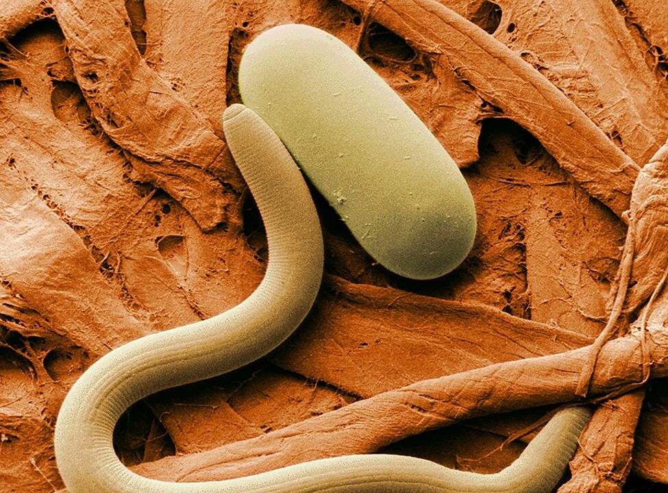 how the worm infection occurs
