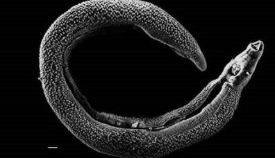 What parasites can live in a man's liver