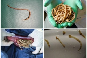 what parasites can live in human intestines